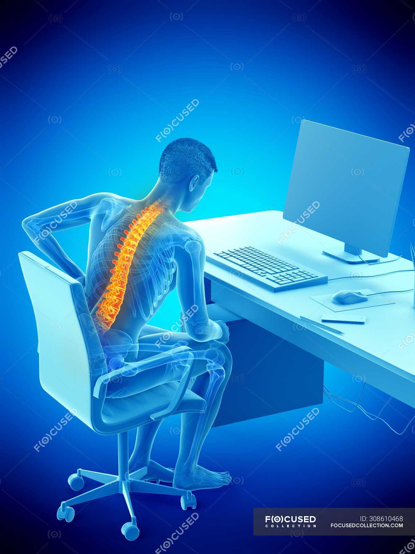 Silhouette of office worker with back pain due to sitting, conceptual  illustration. — anatomical, skeletal system - Stock Photo | #308610468