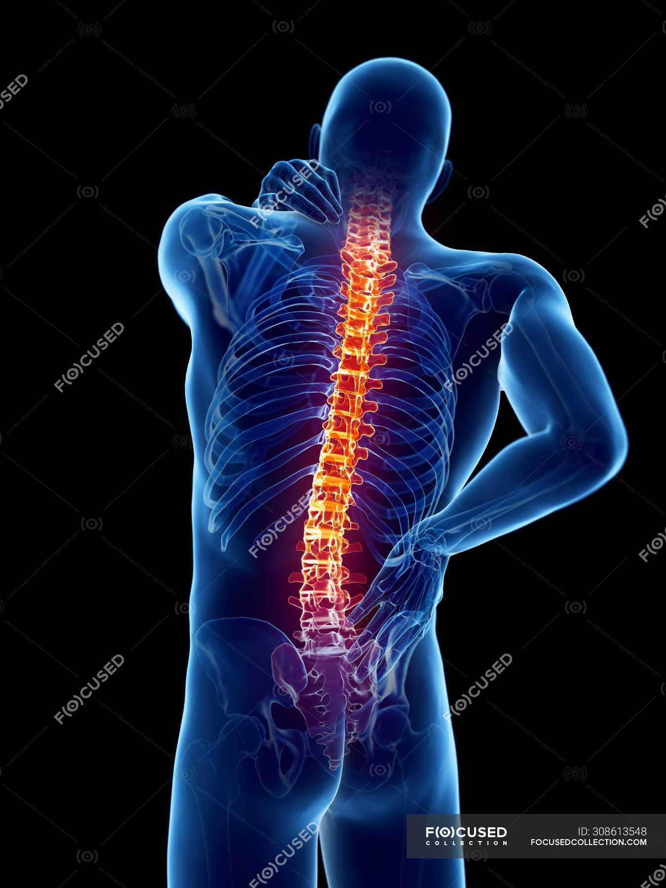 male-body-with-back-pain-on-black-background-digital-illustration-intervertebral-discs