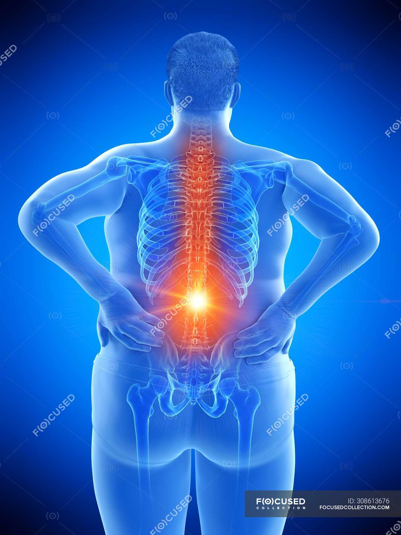 Rear View Of Overweight Male Body With Back Pain Conceptual Illustration Human Anatomy Plump Stock Photo 308613676