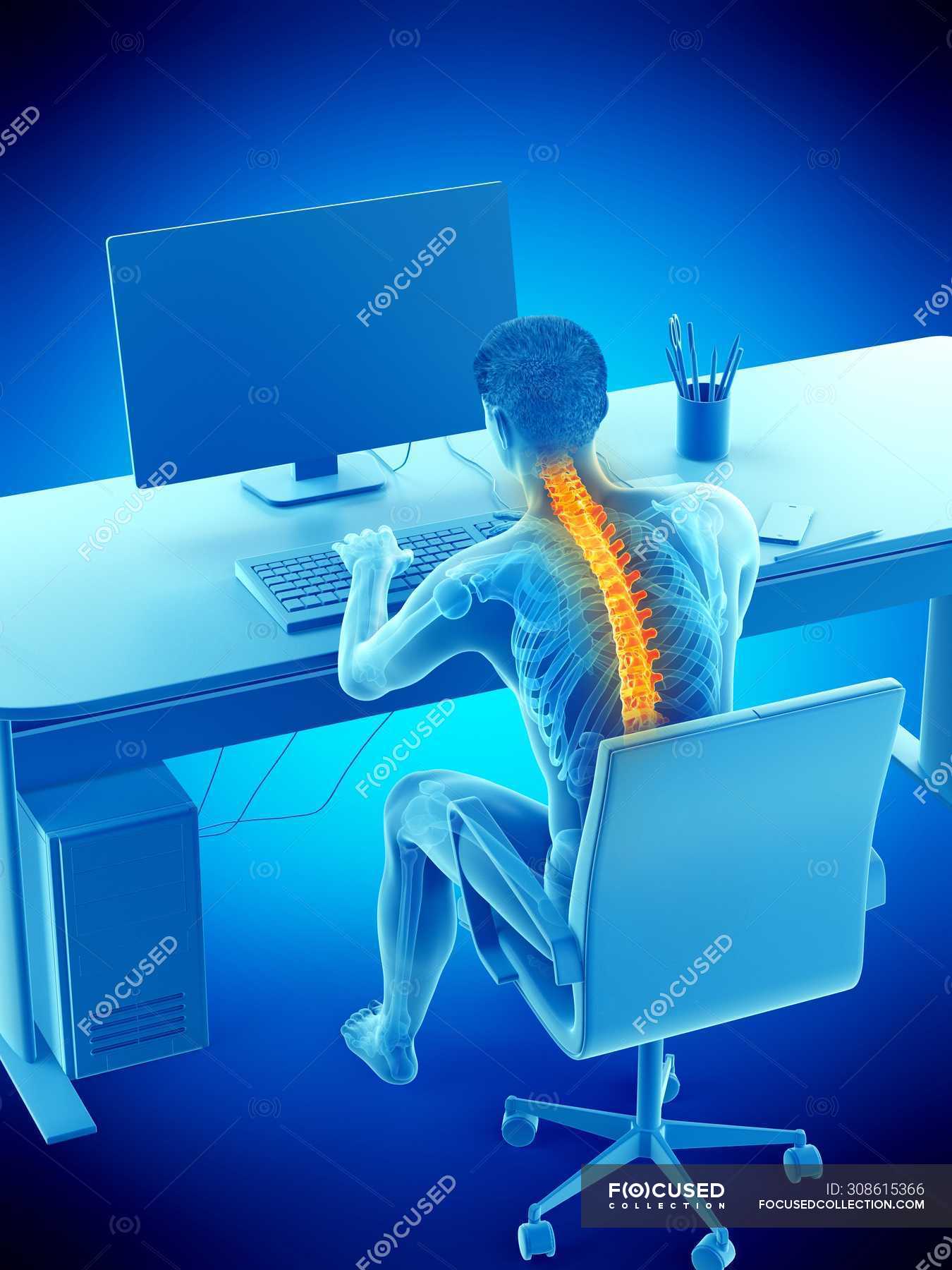 Back Pain Of Office Worker Sitting And Working At Desk Conceptual back-pain-of-office-worker-sitting-and-working-at-desk-conceptual