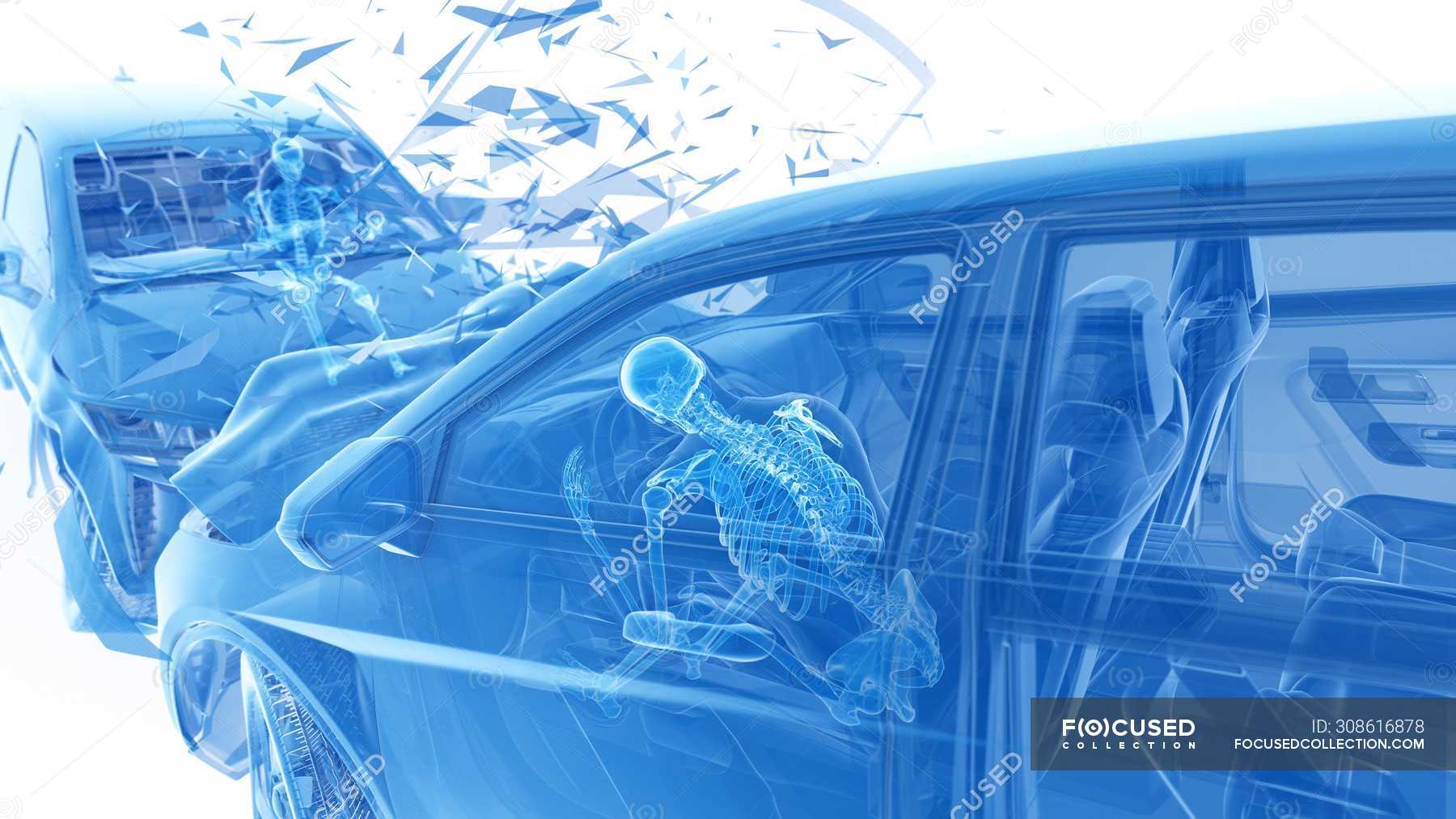 X-ray illustration of risk of injury while head-on car crash, digital ...