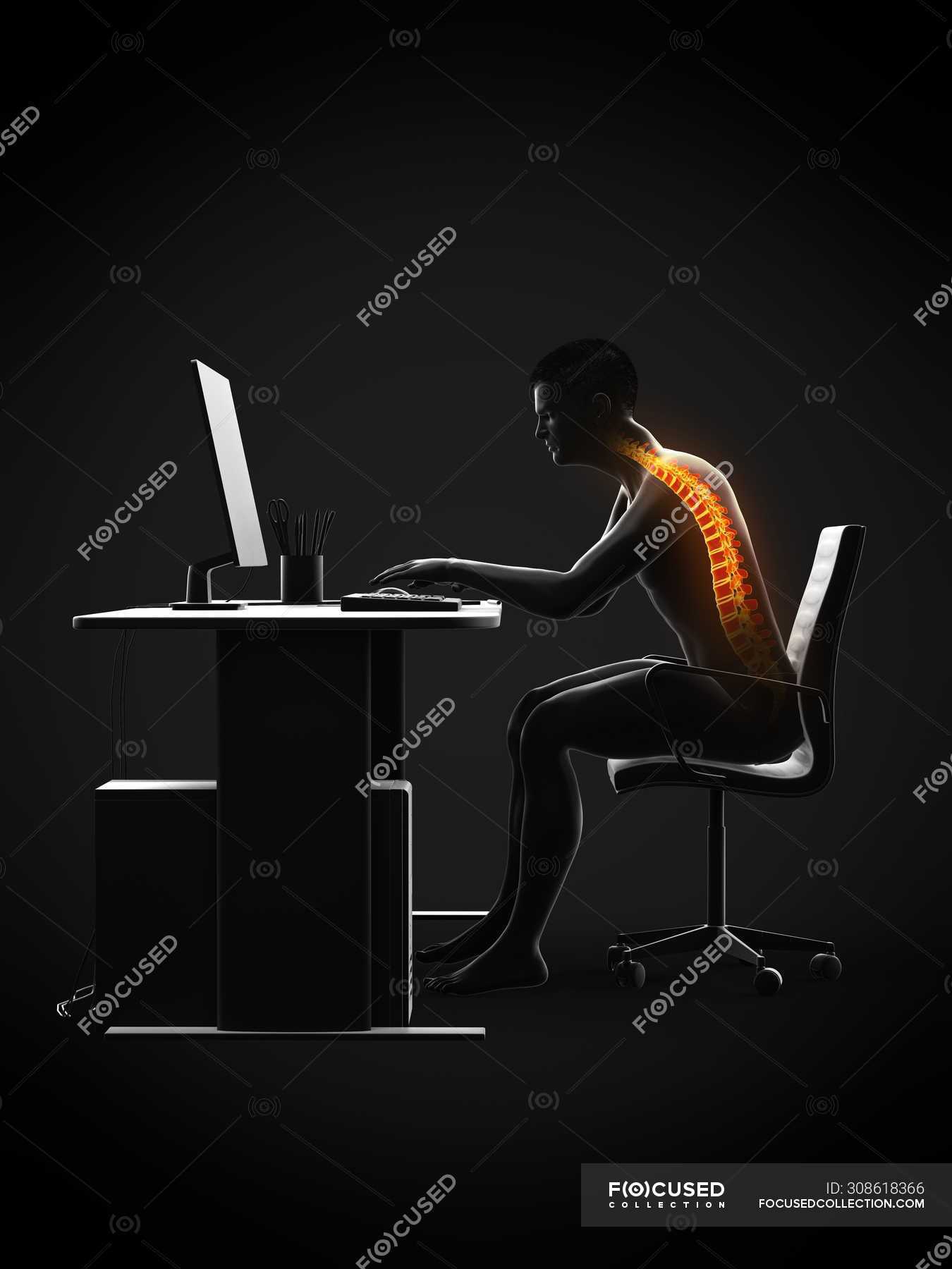 Back Pain Of Office Worker Sitting And Working At Desk Conceptual