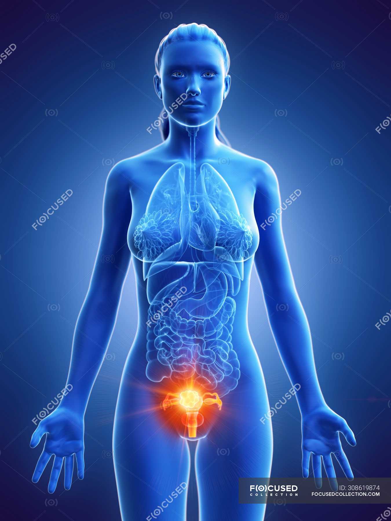 uterine-cancer-in-female-body-conceptual-computer-illustration