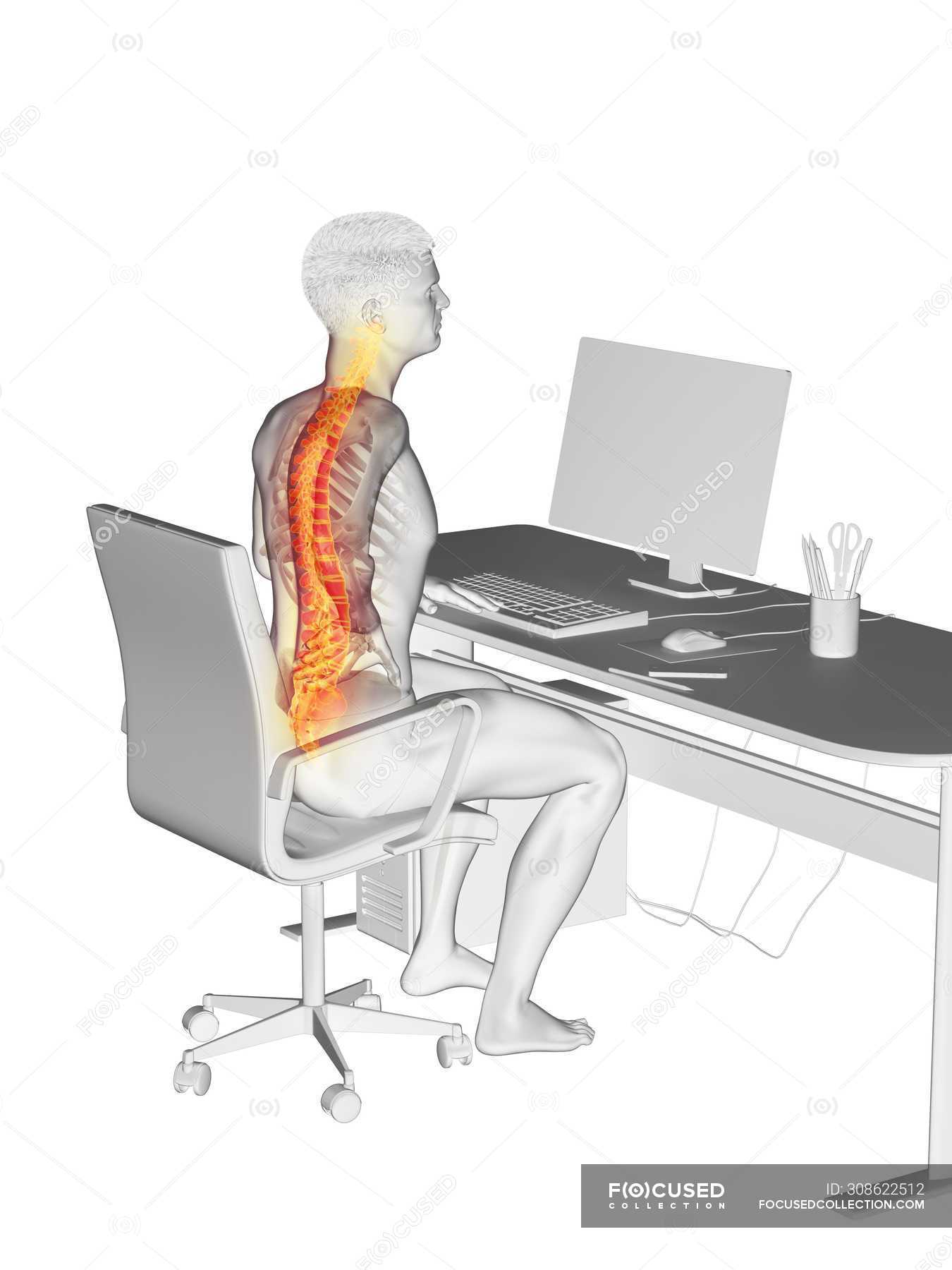 Office Worker Silhouette Sitting At Desk With Back Pain