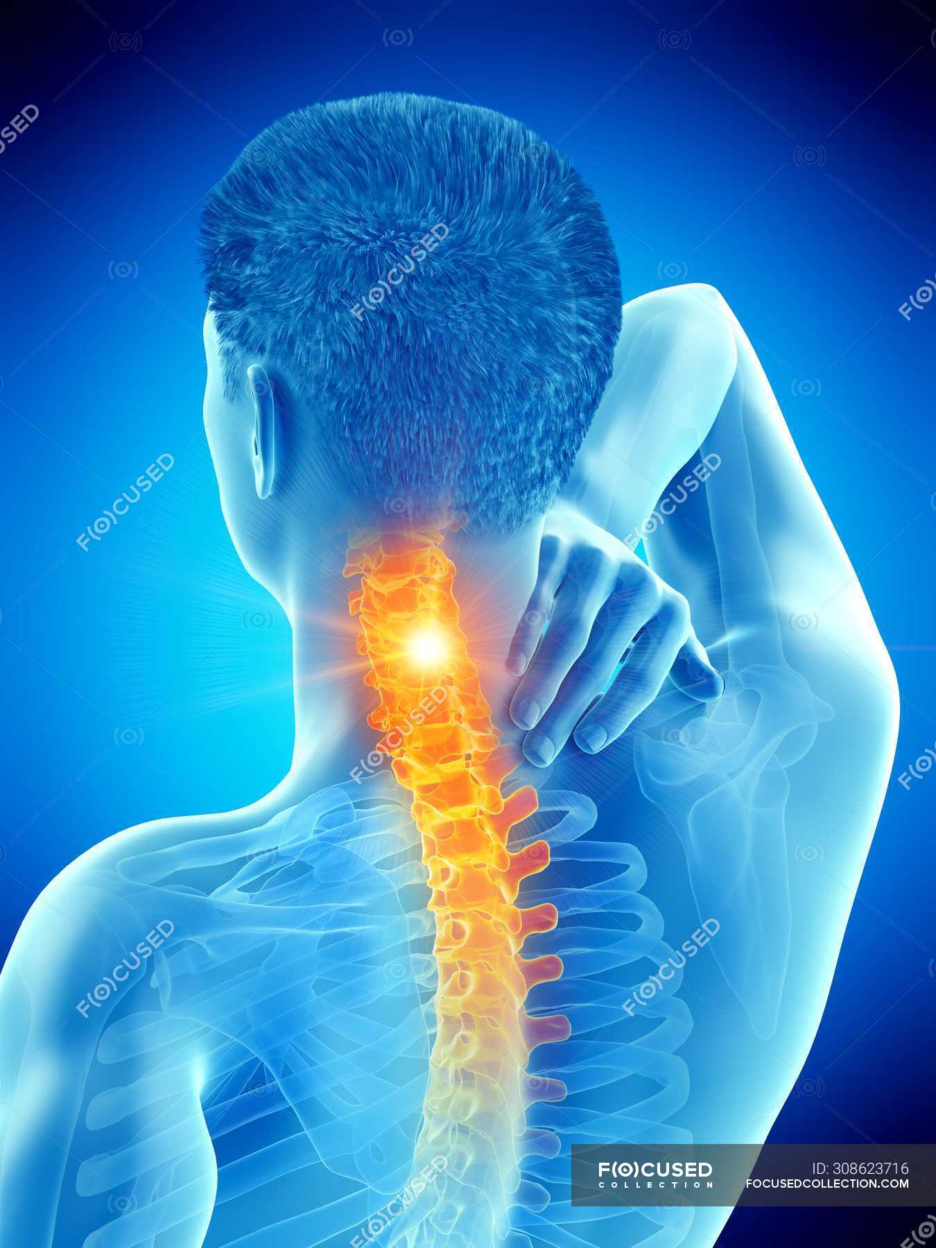 abstract-male-body-with-visible-neck-pain-digital-illustration