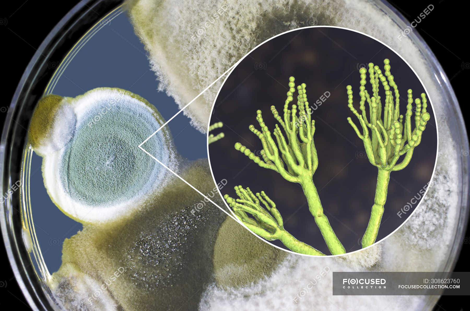 плесневые грибы пенициллиум. пеницилл в чашке петри. плесневые грибы пенициллин. плесень флеминга пенициллин. пенициллин плесень.