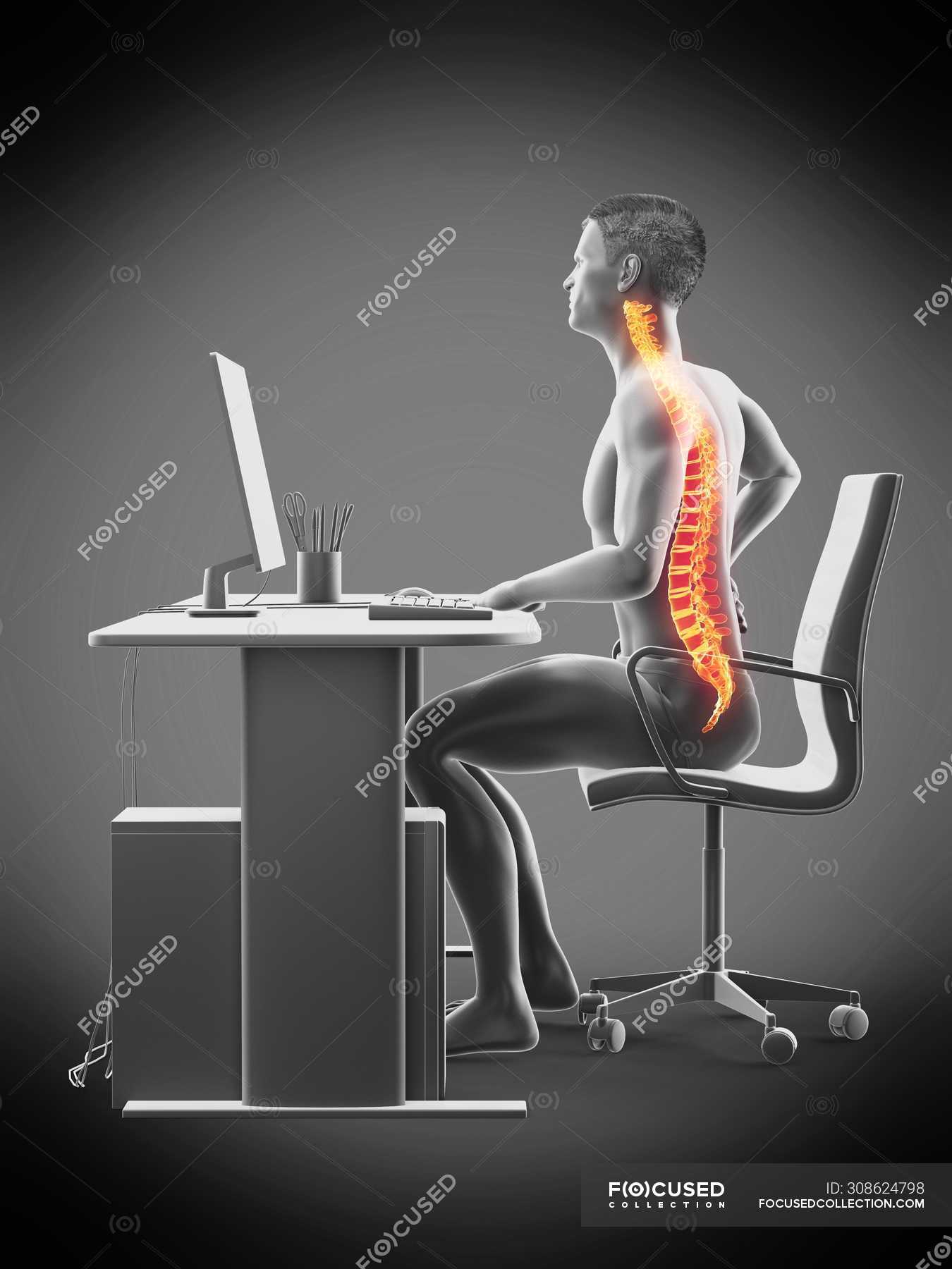 Male office worker with back pain, conceptual illustration. — chair, spine  - Stock Photo | #308624798