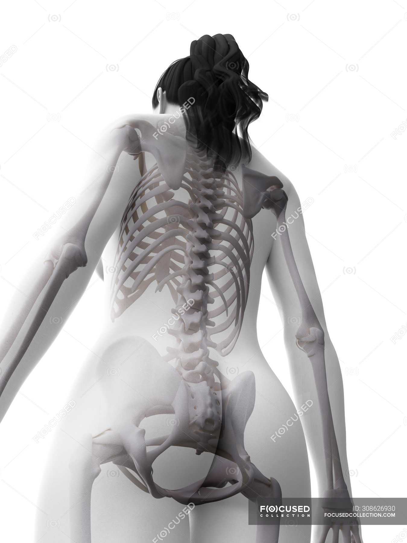 Рентген женского тела