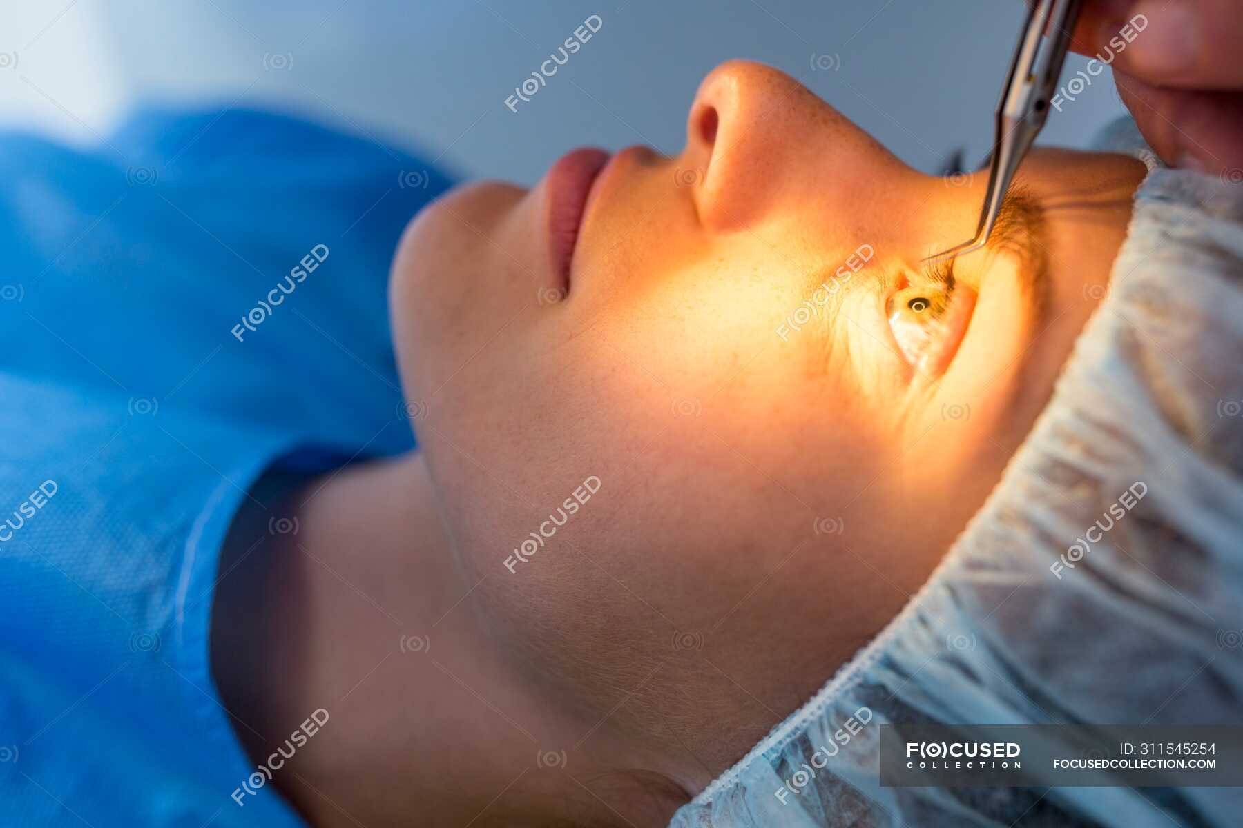 patient-undergoing-laser-eye-surgery-ocular-lasik-stock-photo