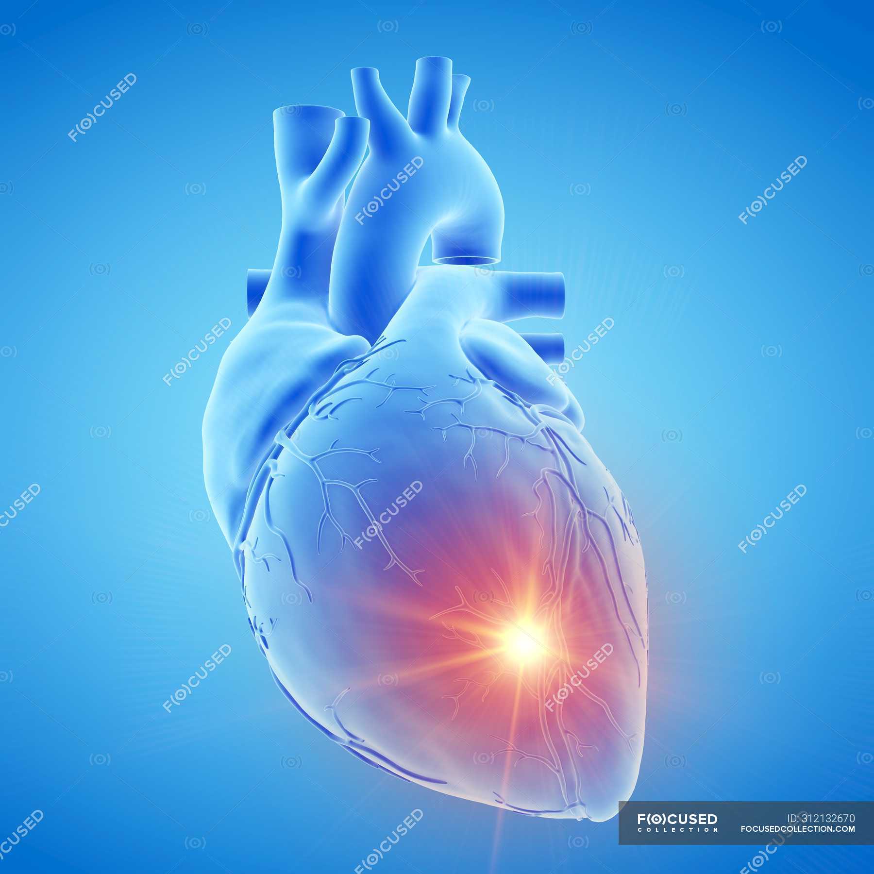 Diseased Human Heart Images