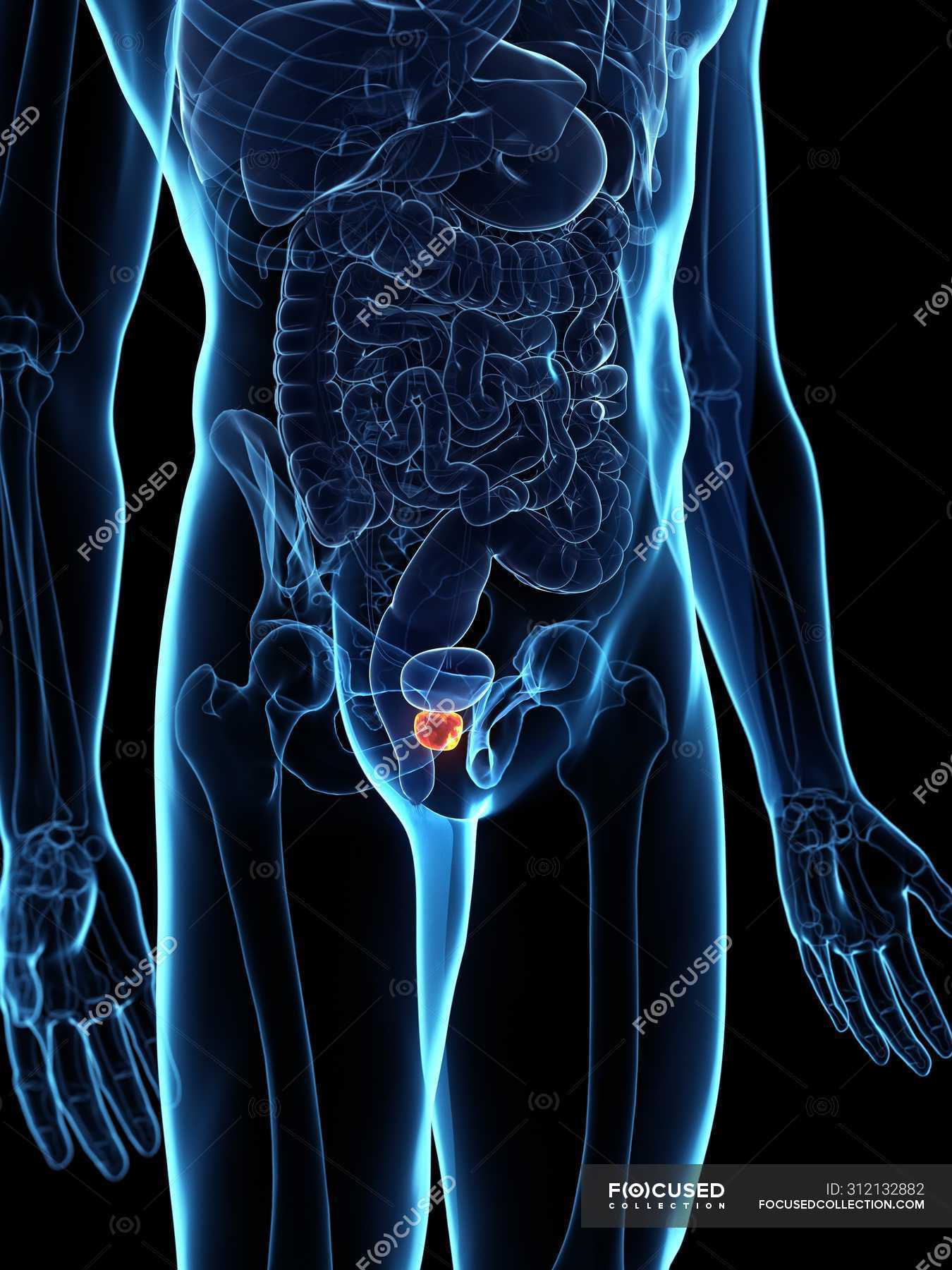 inflamed-prostate-in-abstract-male-body-digital-illustration