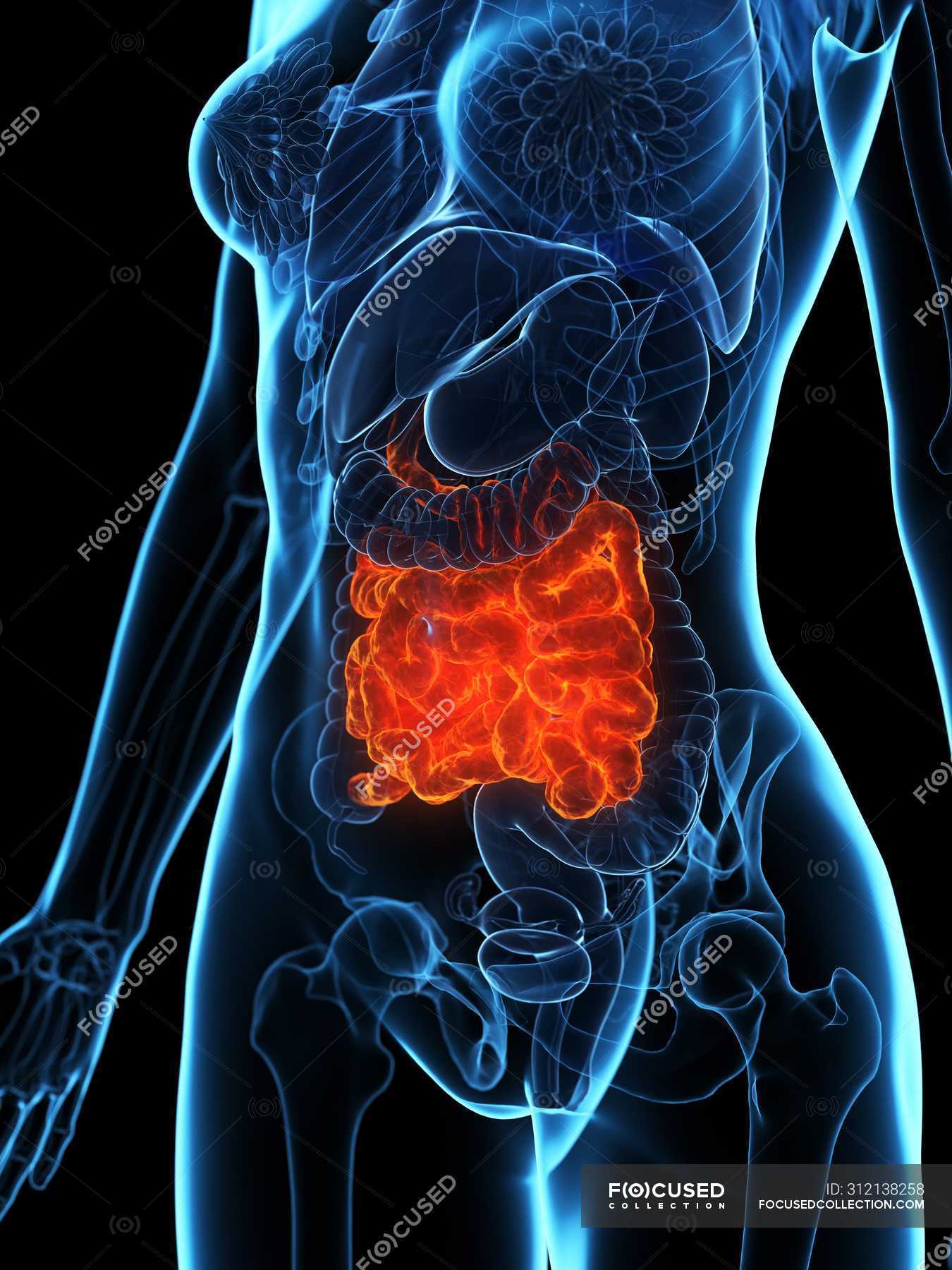 Diseased small intestine in female body transparent silhouette on black ...