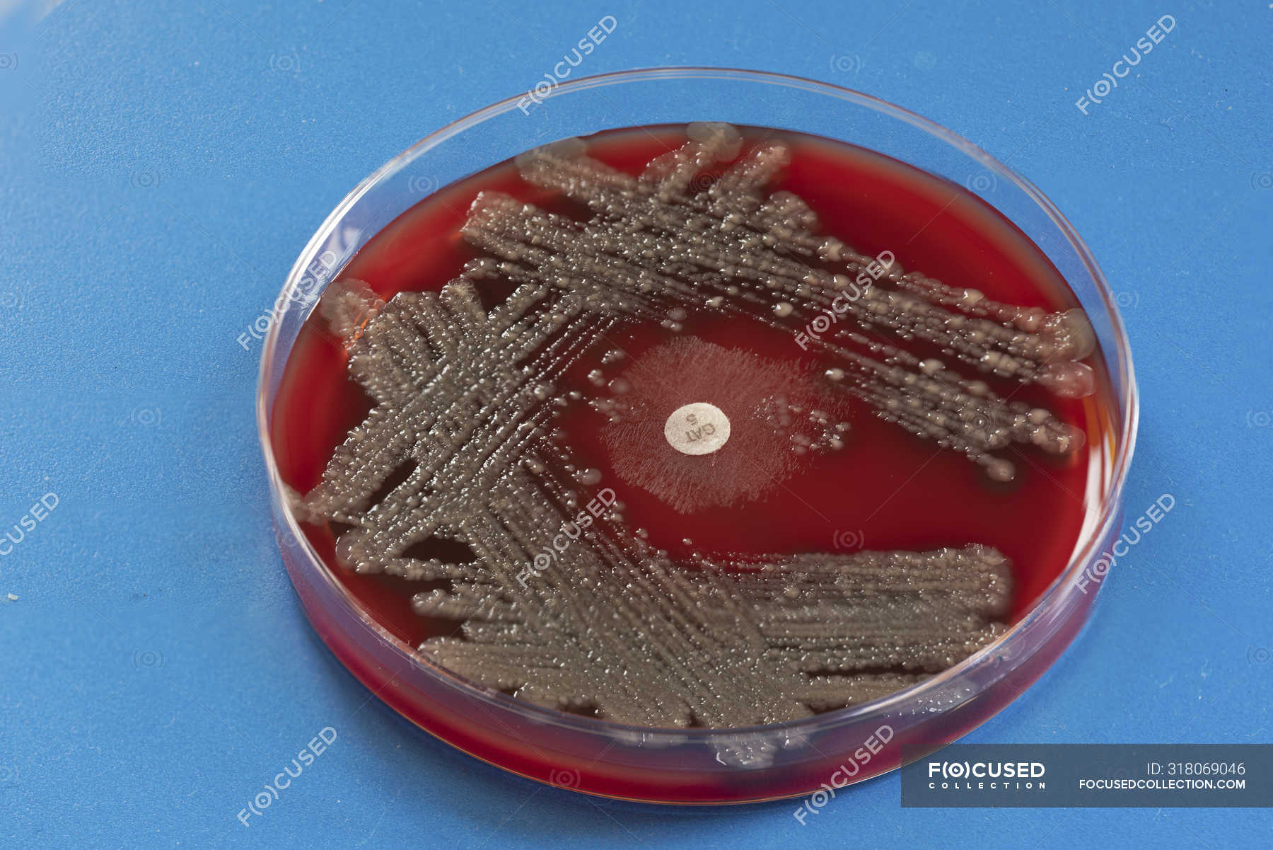 close-up-of-agar-plate-with-stool-culture-medical-growth-stock