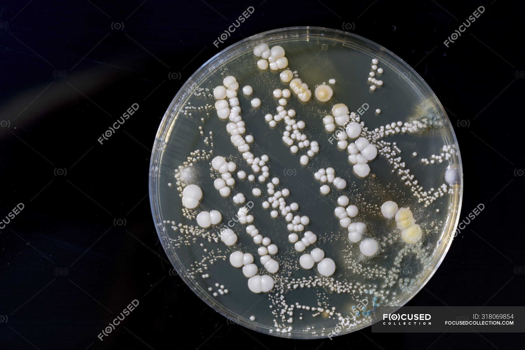 petri dish bacteria identification