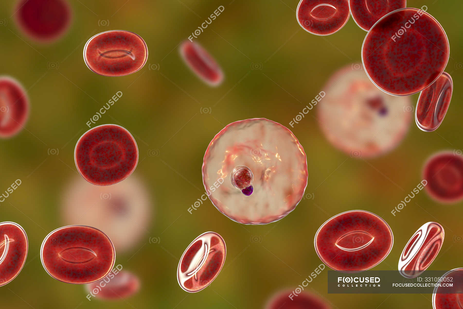 Plasmodium malariae protozoa in blood vessel, computer illustration