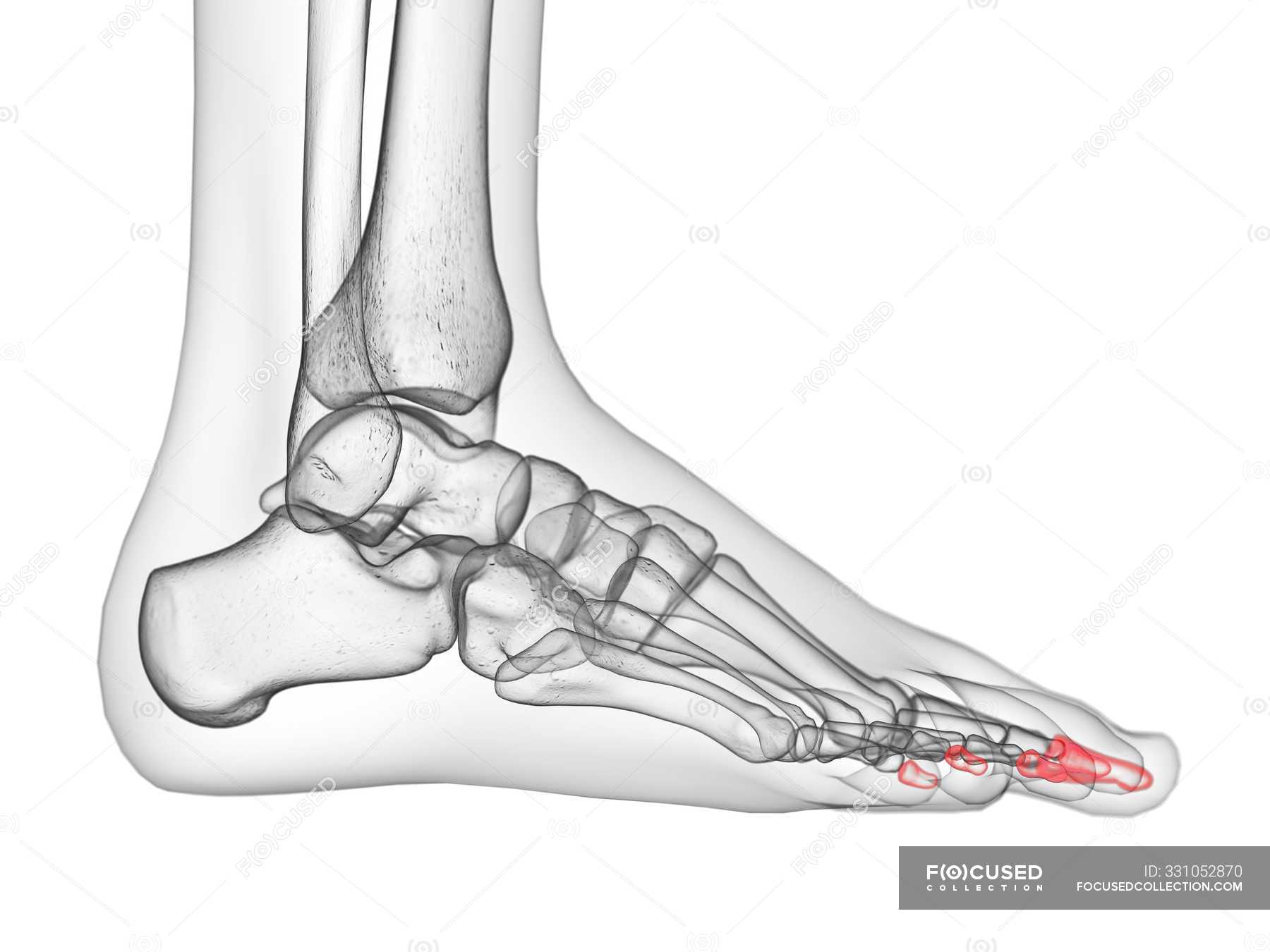 Distal Phalanx Bones In X Ray Computer Illustration Of Human Foot