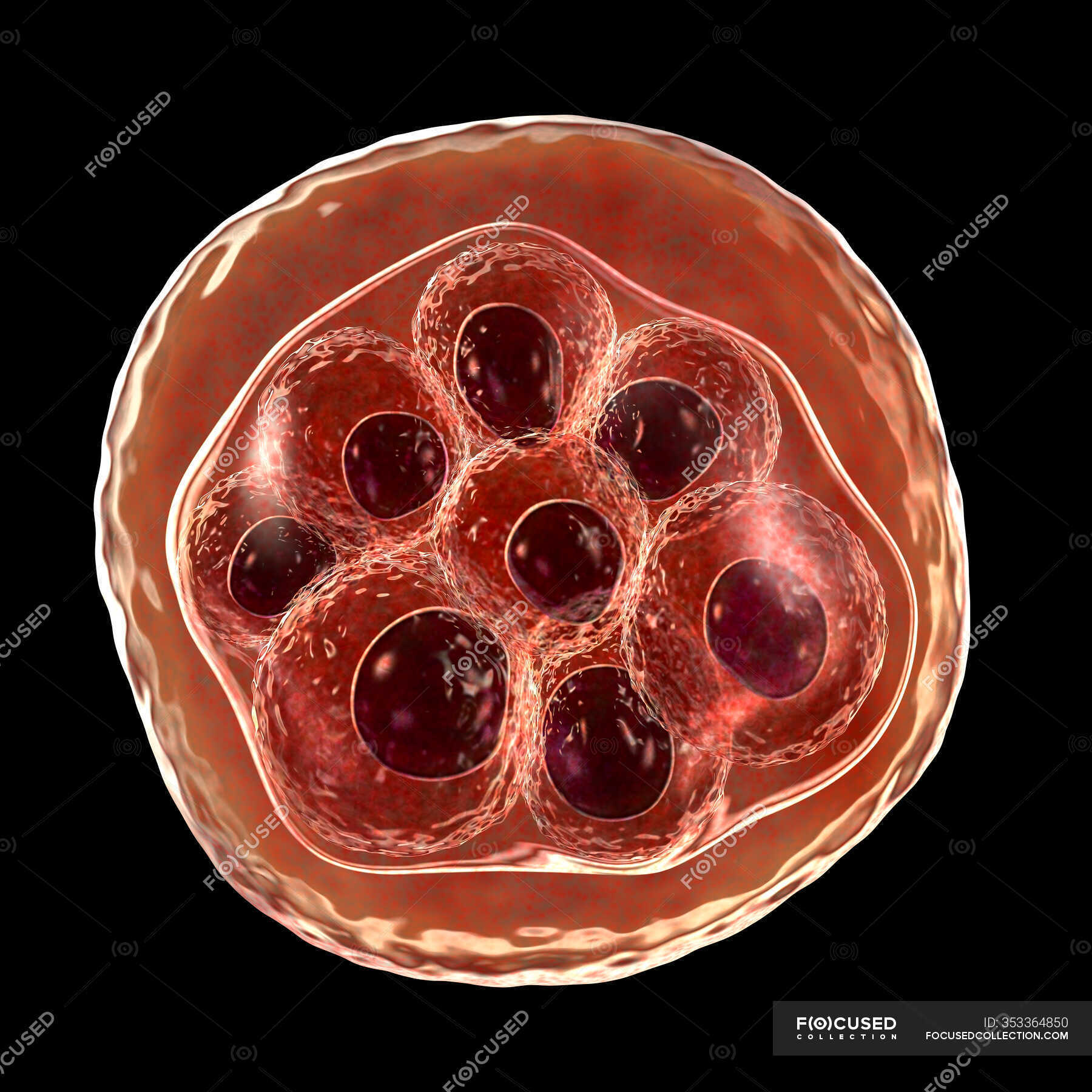 Red blood cell infected with Plasmodium sp. parasites (at schizont ...