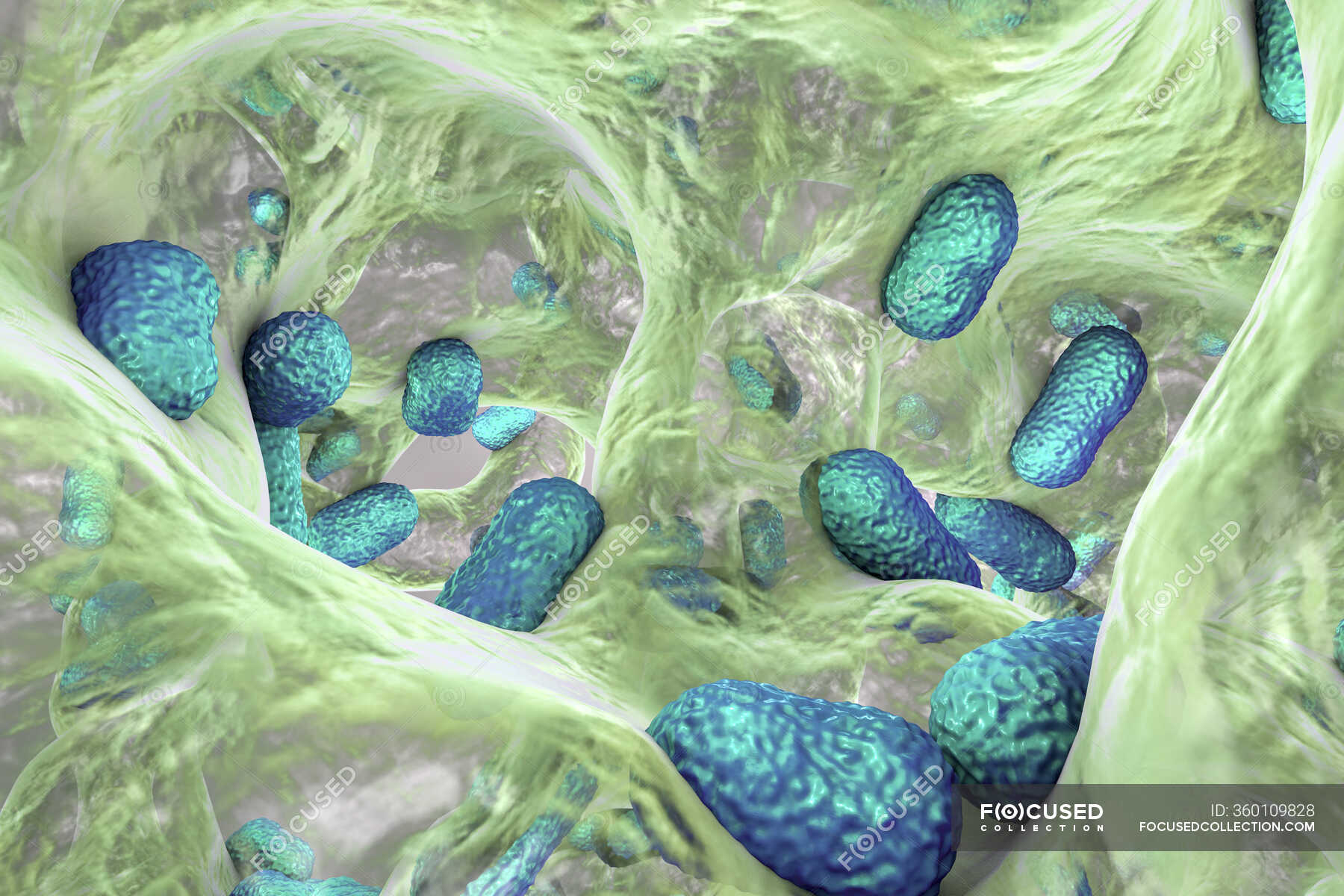Multidrug resistant baumannii bacteria inside biofilm