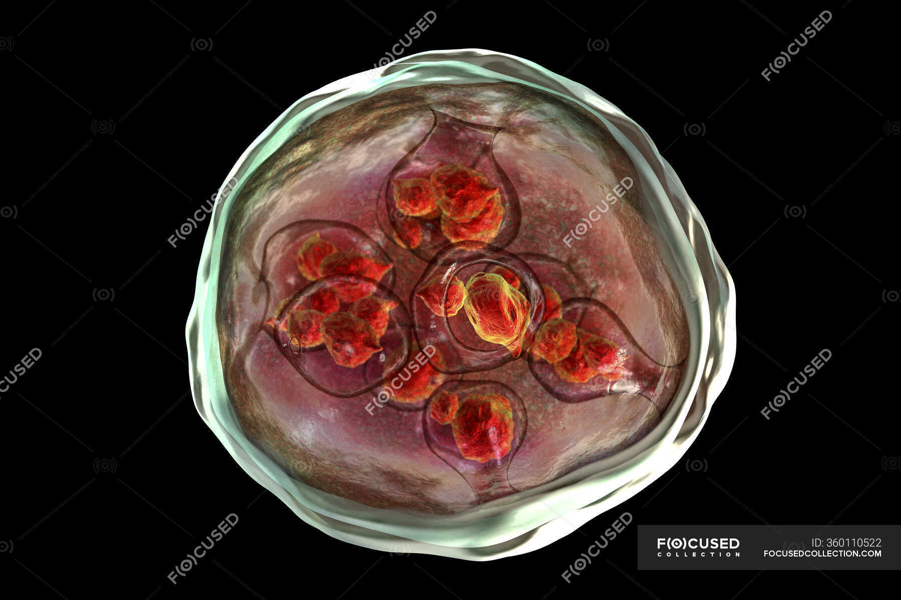 Echinococcus granulosus hydatid cyst, computer illustration ...