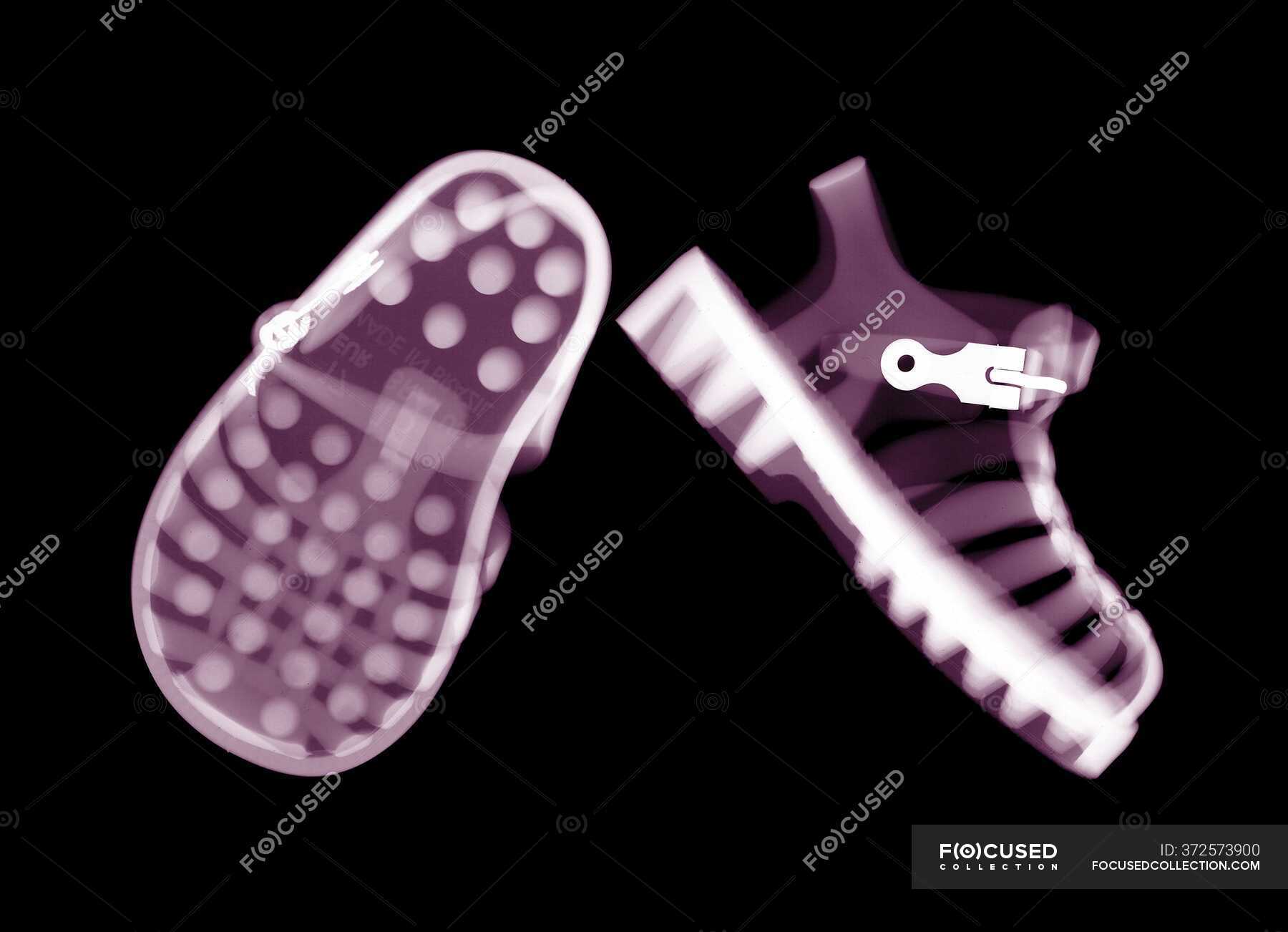 child jelly shoes