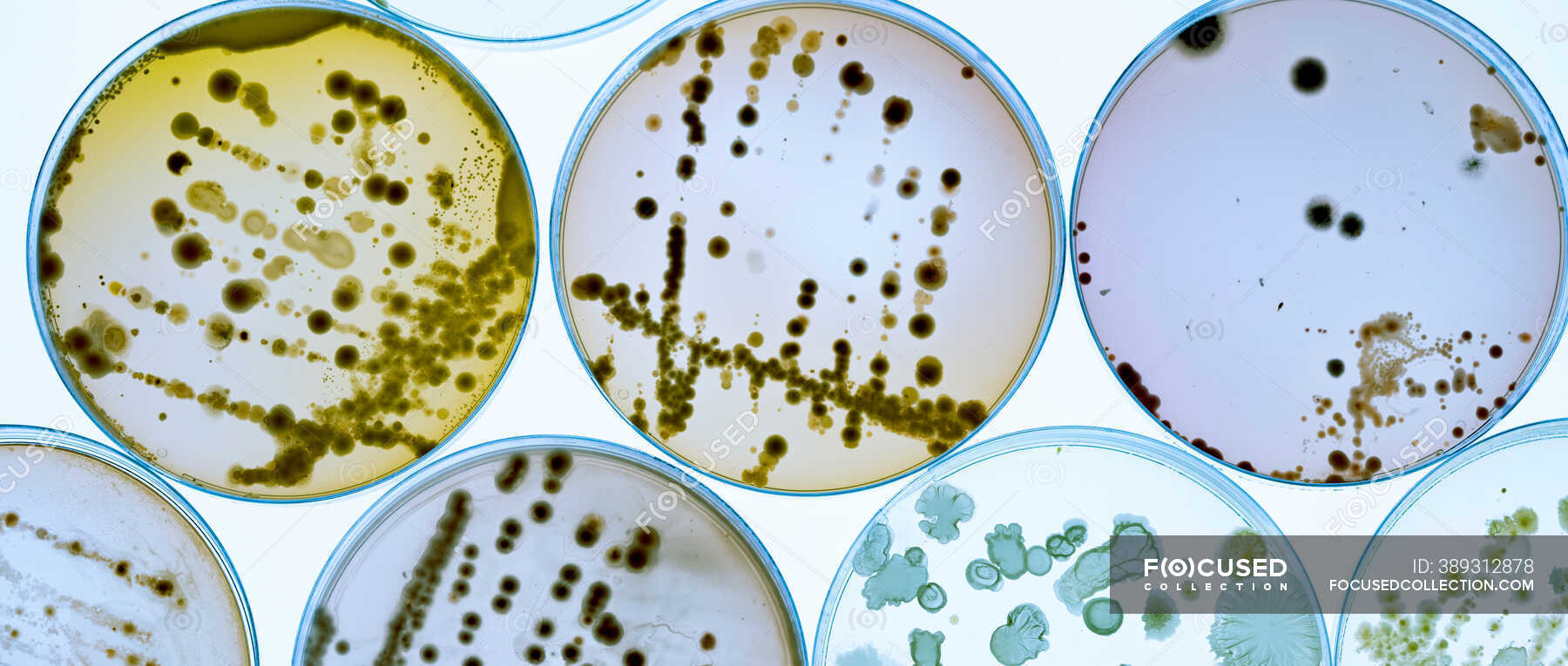 Bacterial colonies on agar plates — petri, medicine Stock Photo