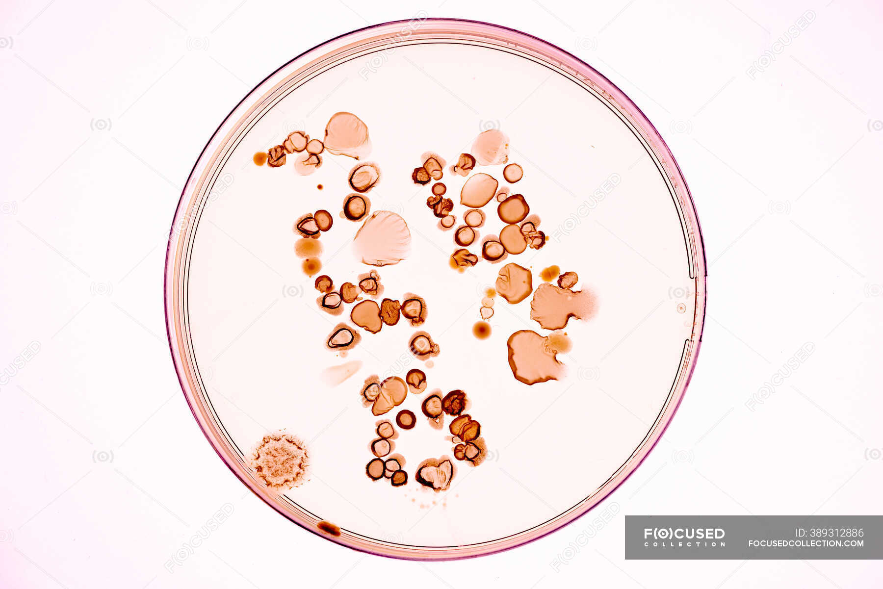 Bacterial Colonies On Agar Plate. — Bacterium, Petri - Stock Photo ...