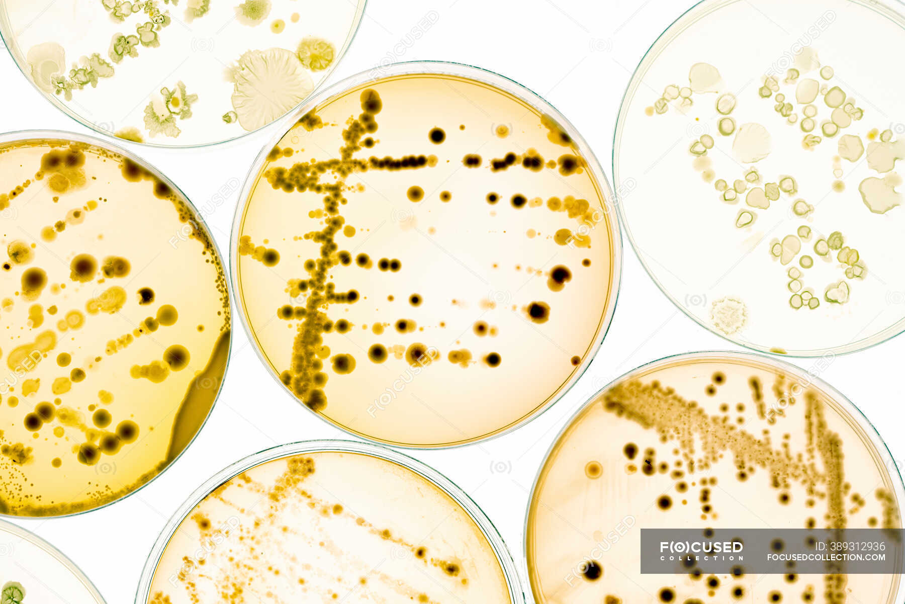 Bacterial colonies on agar plates — dishes, sample Stock Photo
