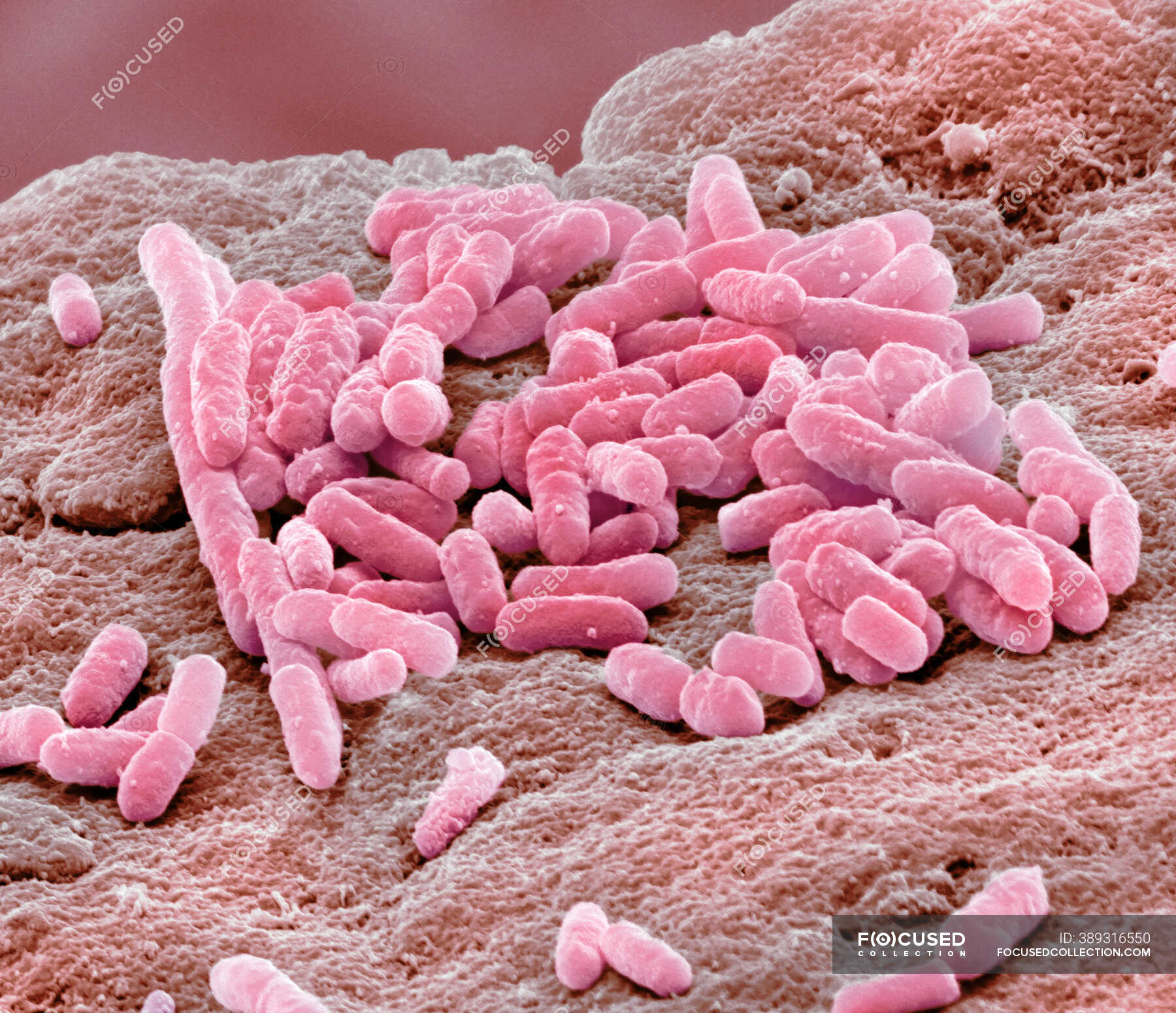 E Coli Micrograph