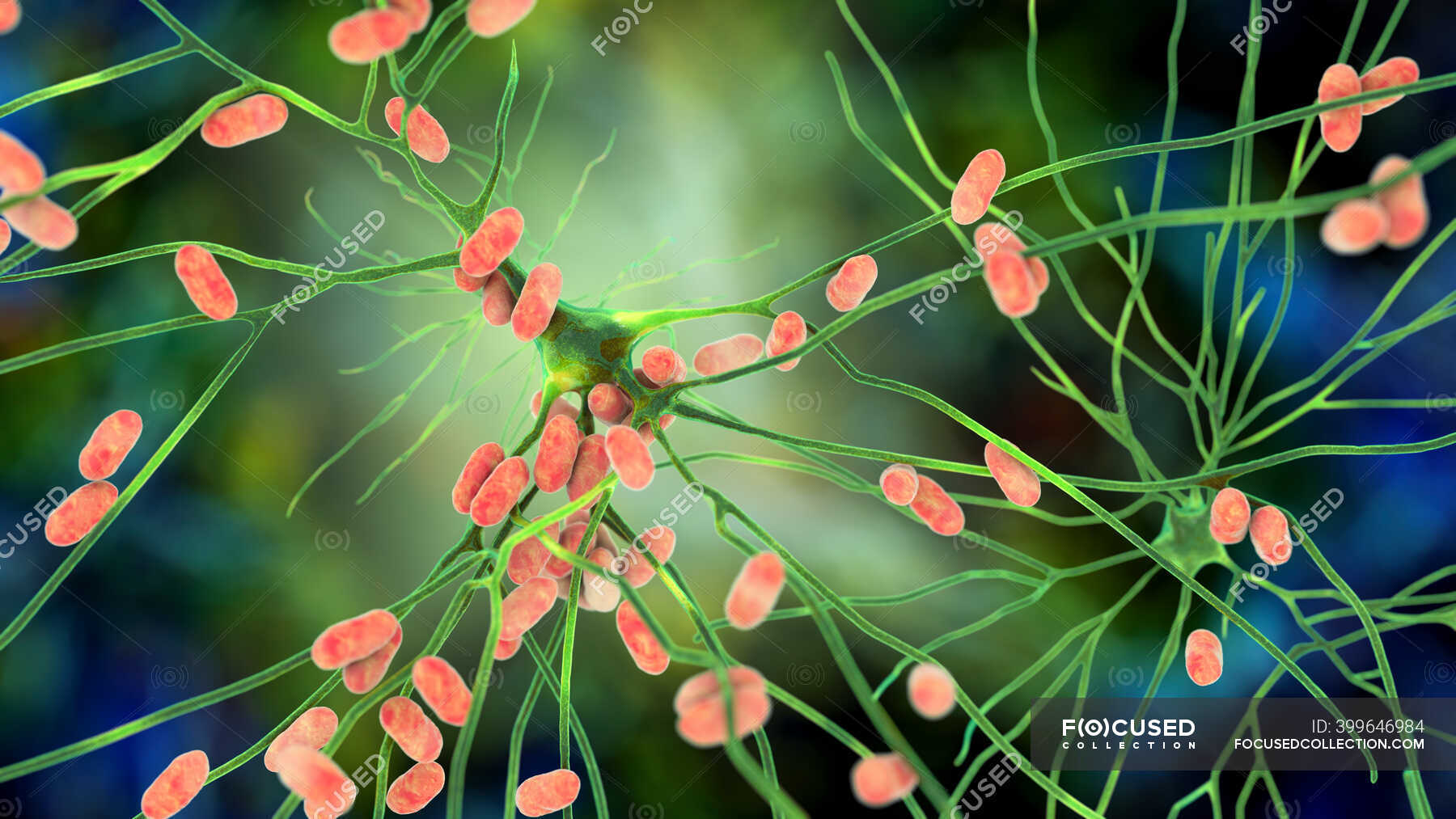 Bacterial Encephalitis Conceptual Computer Illustration Showing   Focused 399646984 Stock Photo Bacterial Encephalitis Conceptual Computer Illustration 