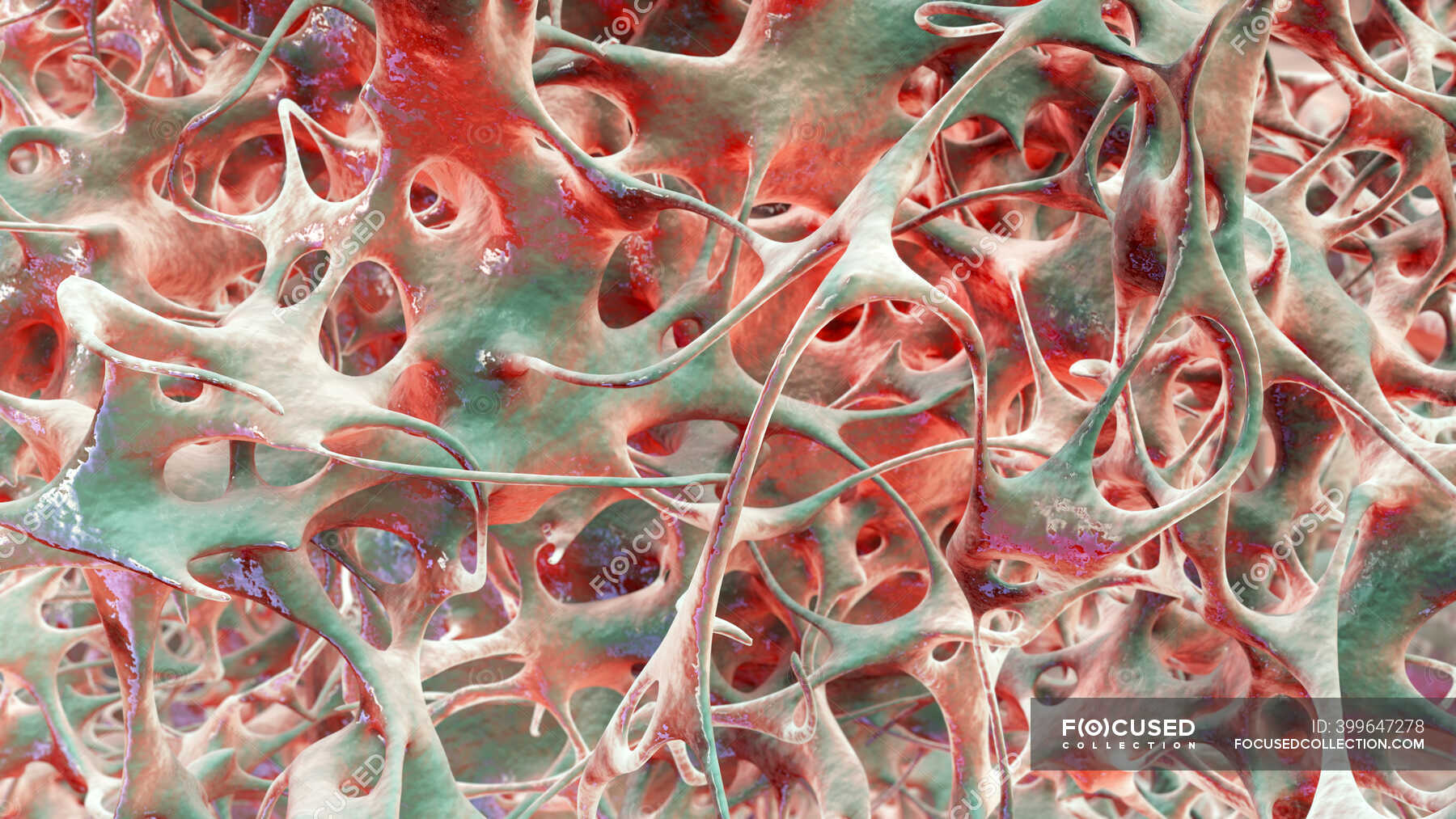 Костные матрицы. Коллагеновые волокна в костной ткани. Коллагеновый матрикс кости. Остеопороз гистология. Костные матрицы.