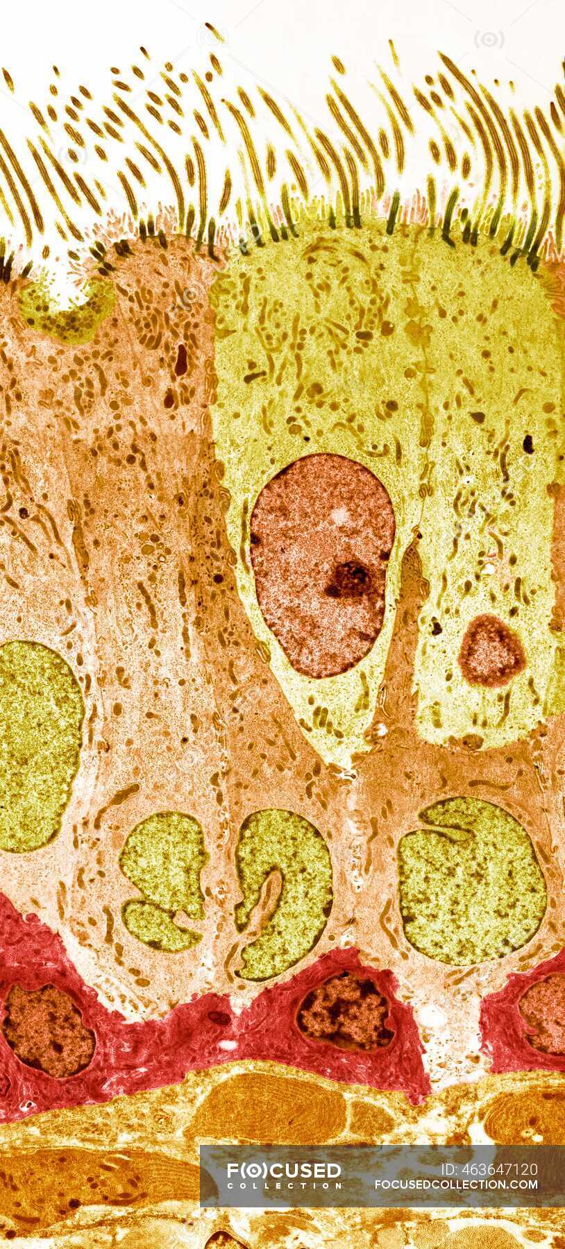 trachea-lining-coloured-transmission-electron-micrograph-tem-of-a