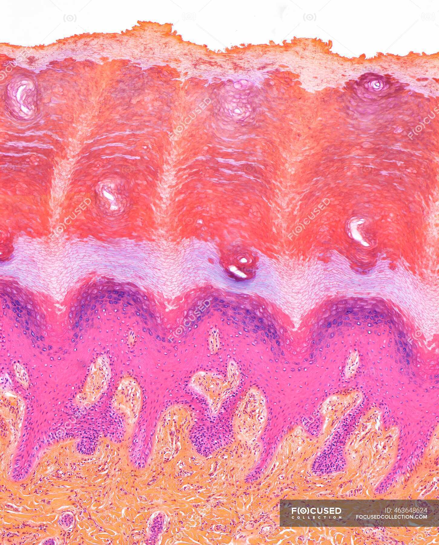 Plantar skin, light micrograph (LM) of sectioned foot sole skin. The