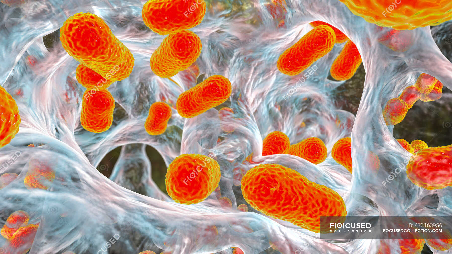 Multidrug resistant baumannii bacteria inside biofilm