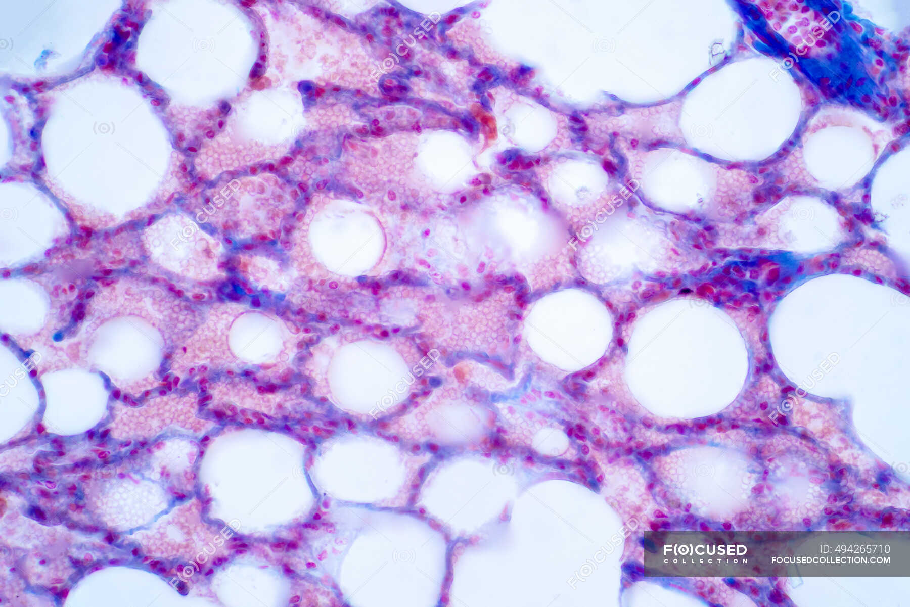 Menschliches Lungengewebe, leichte Mikrographie. Lungen sind die