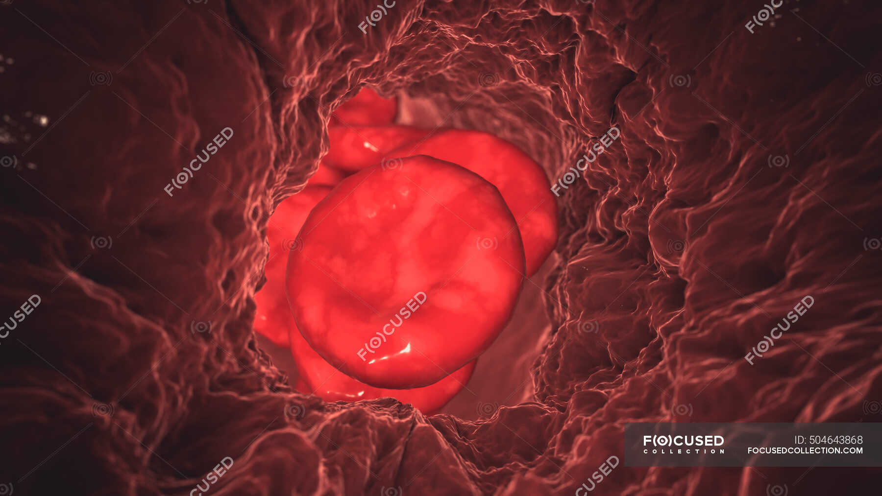 blood-clot-computer-illustration-biological-particles-stock-photo