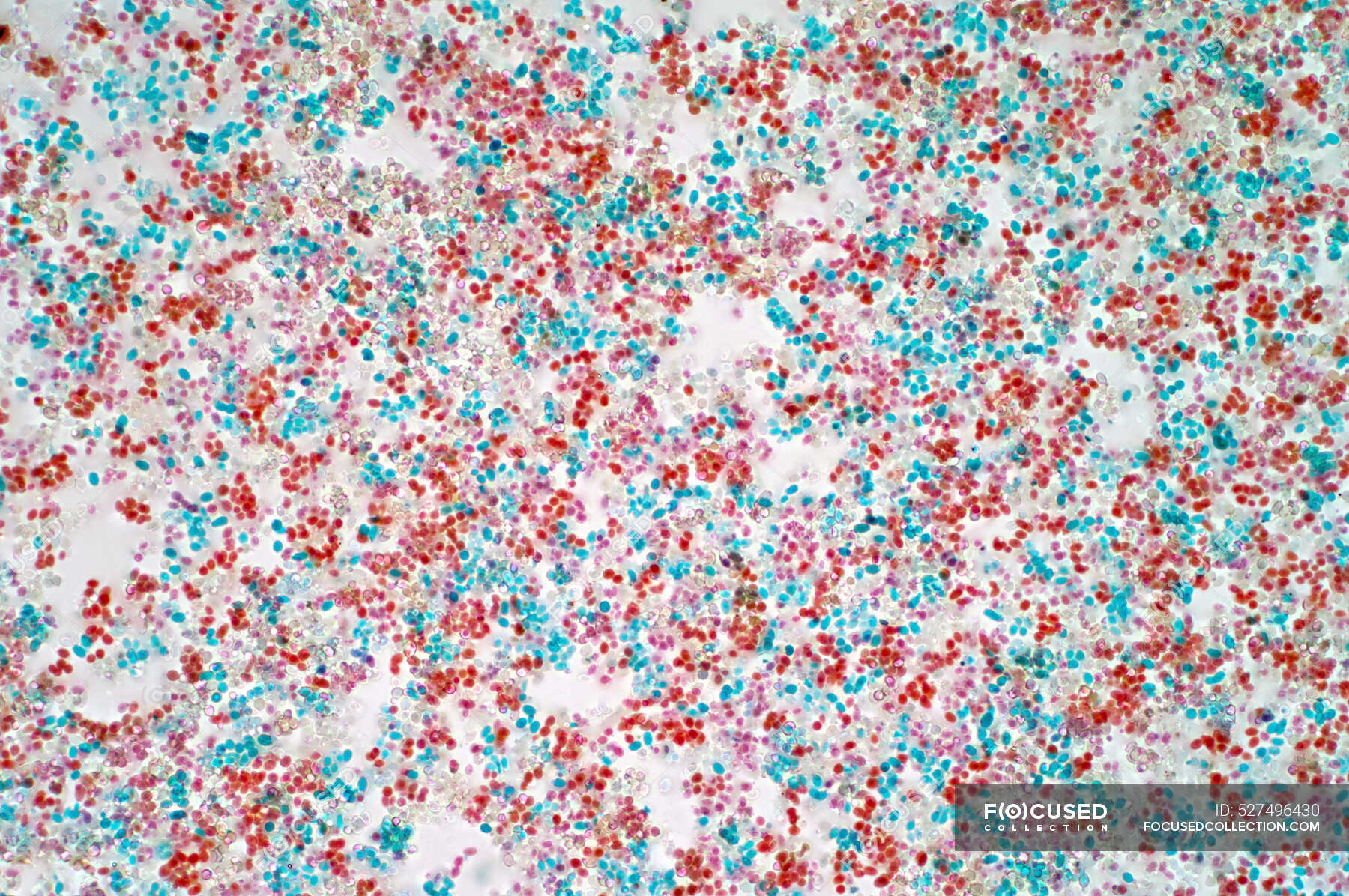 Light micrograph of brewer's yeast (Saccharomyces cerevisiae) yeast