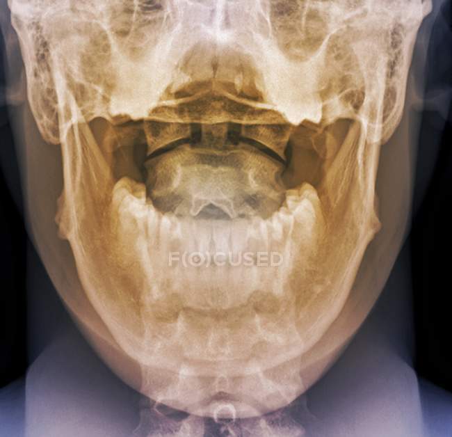 Articolazione tra cranio e collo — Foto stock