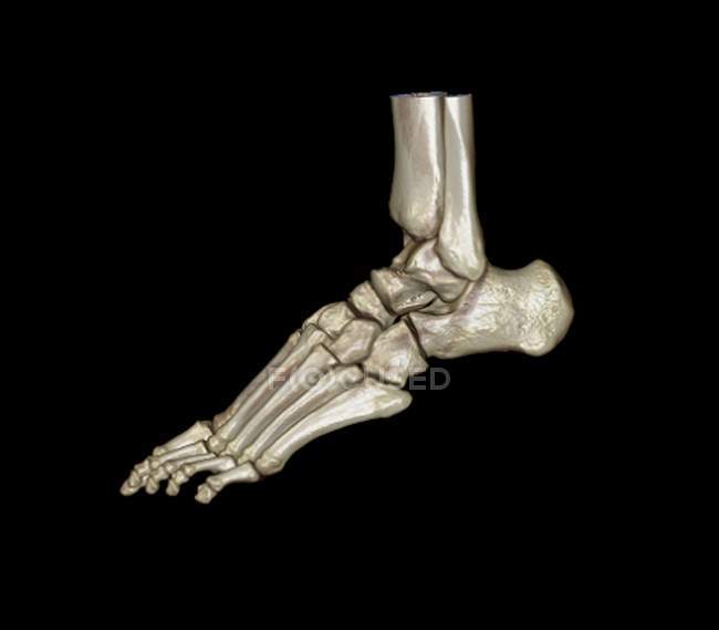 Tomodensitométrie 3D colorée (TDM) du pied sain d'un patient de 23 ans . — Photo de stock