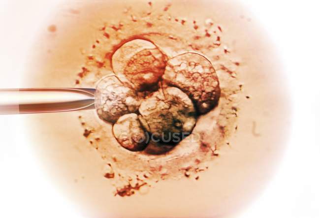 Selezione embrioni per fecondazione in vitro — Foto stock