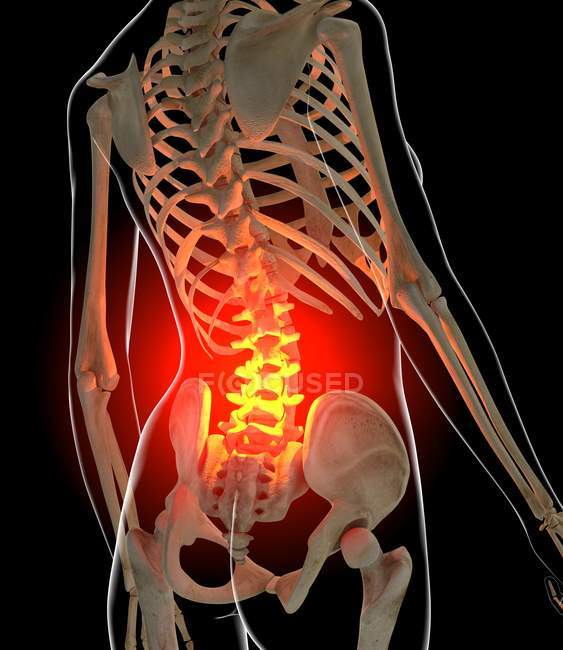 Pain localized in lumbar section of spine — Stock Photo