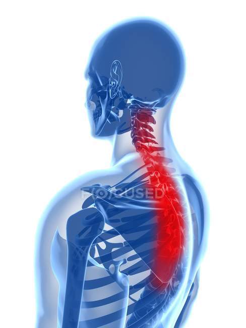 Localisation des maux de dos dans la section vertébrale — Photo de stock