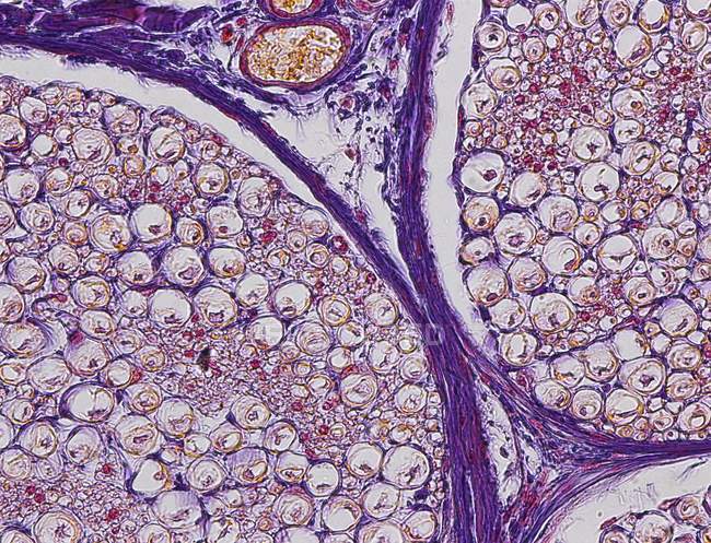 Седалищный нерв показывает связку нервных волокон — стоковое фото