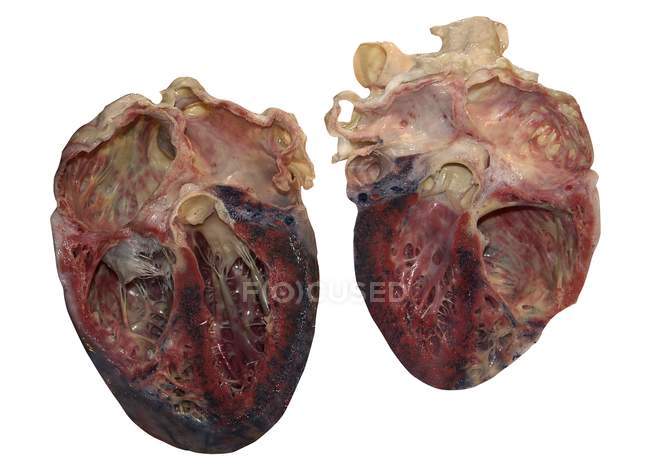 Corazón humano diseccionado sobre fondo blanco . - foto de stock