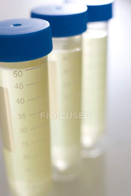 Close-up de tubos de amostra com amostras médicas . — Fotografia de Stock