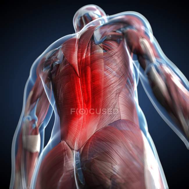 Визуальный рендеринг боли в спине — стоковое фото