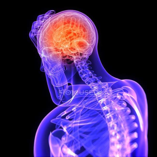 Kopfschmerzen im Schläfen- und Parietallappen lokalisiert — Stockfoto