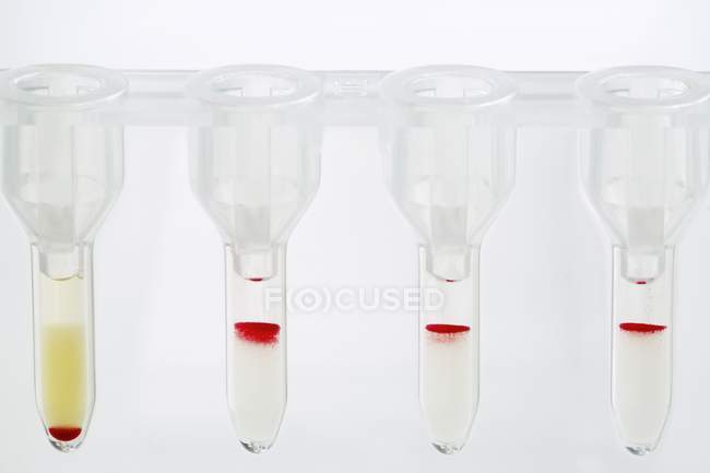 Primer plano de los recipientes para la prueba del grupo sanguíneo . - foto de stock