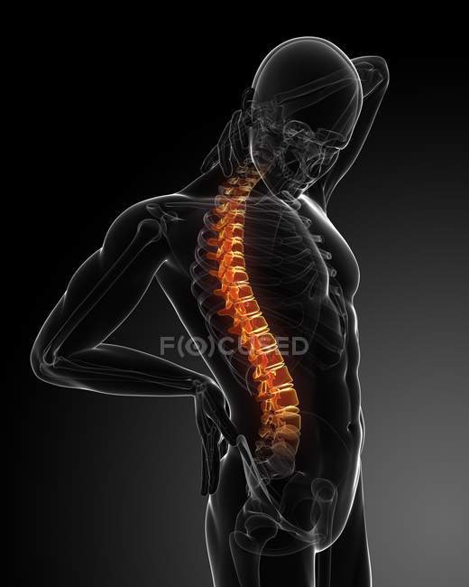 Локализация болей в спине — стоковое фото