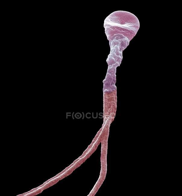Sperm cell with multiple tails — Stock Photo