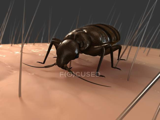 Parasitic Bedbug on human skin — Stock Photo